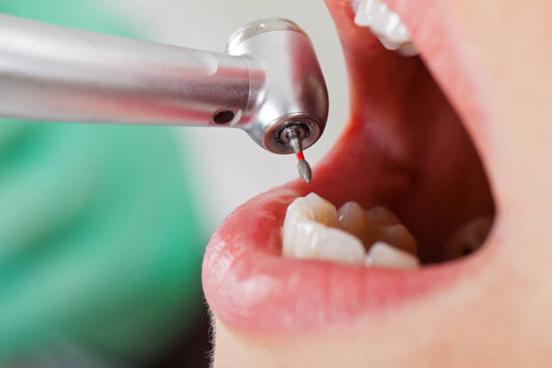 Best Walk-In Emergency Dentist in Bridgeport, WA